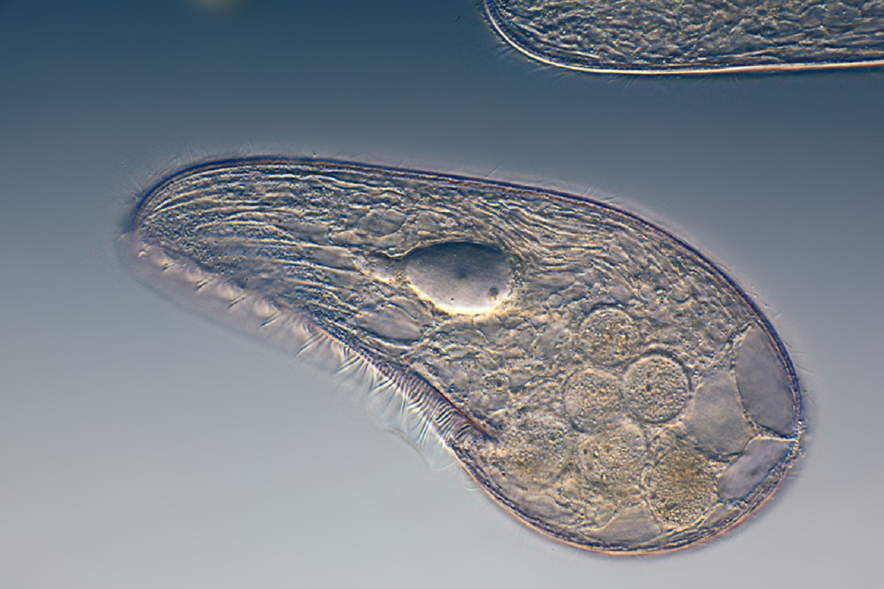 Blepharisma japonicum, a free-living ciliated protozoan, singe cell organism. Credit: Frank Fox