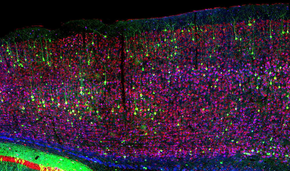 Close-up of neurons in a mouse. Credit: National Institute of Child Health and Human Development / Flickr