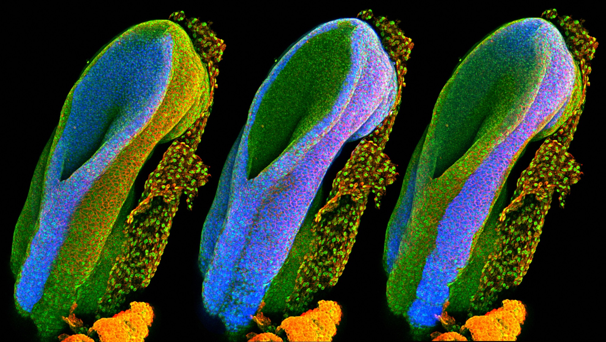 Our spines allow us to stand and move, and they protect the spinal cord, which connects all the nerves in our body with our brain. The spinal cord is formed from a structure called the neural tube, which develops during the first month of pregnancy. This series of three images shows the open end of a mouse’s neural tube, with each image highlighting (in blue) one of the three main embryonic tissue types. On the left is the neural tube itself, which develops into the brain, spine and nerves. On the right is the surface ectoderm – the word ‘ectoderm’ comes from the Greek ektos meaning ‘outside’ and derma meaning skin – which will eventually form the skin, teeth and hair. The middle image shows the mesoderm (also from Greek, meaning ‘middle skin’), which will form the organs.