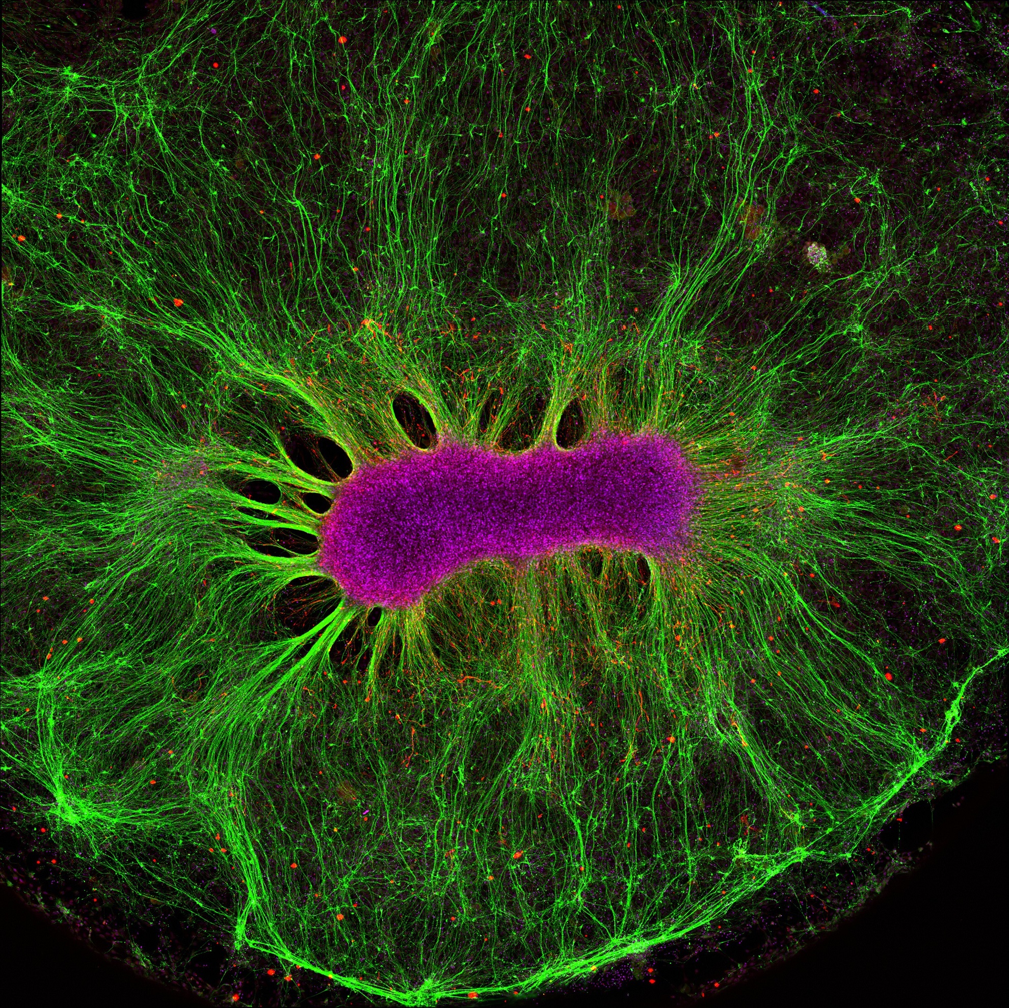 Neural stem cells have the ability to form all the different cell types found in the nervous system. Here, researchers are investigating how neural stem cells grow on a synthetic gel called PEG. After just two weeks, the stem cells (magenta) produced nerve fibres (green). These fibres grew away from the cell due to chemical gradients in the gel, teaching researchers about how their environment affects their structural organisation.