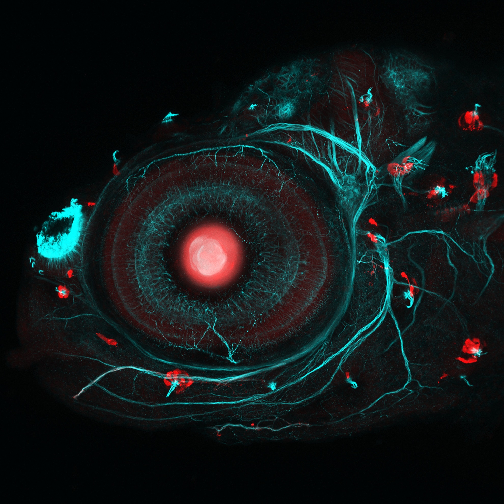 This four-day-old zebrafish embryo has been modified using two mechanisms – borrowed from the fascinating worlds of bacteria and yeast – that are widely applied in genetics research. A DNA-editing technology called CRISPR/Cas9 was used to insert a gene called Gal4 next to the gene that the researchers wished to study. These Gal4 fish were then bred with special reporter fish to create fish where the gene of interest fluoresces red whenever it is activated.