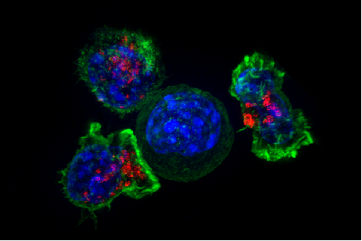 Killer T cells surround a cancer cell. Image credit: NIH Image Gallery / Flickr